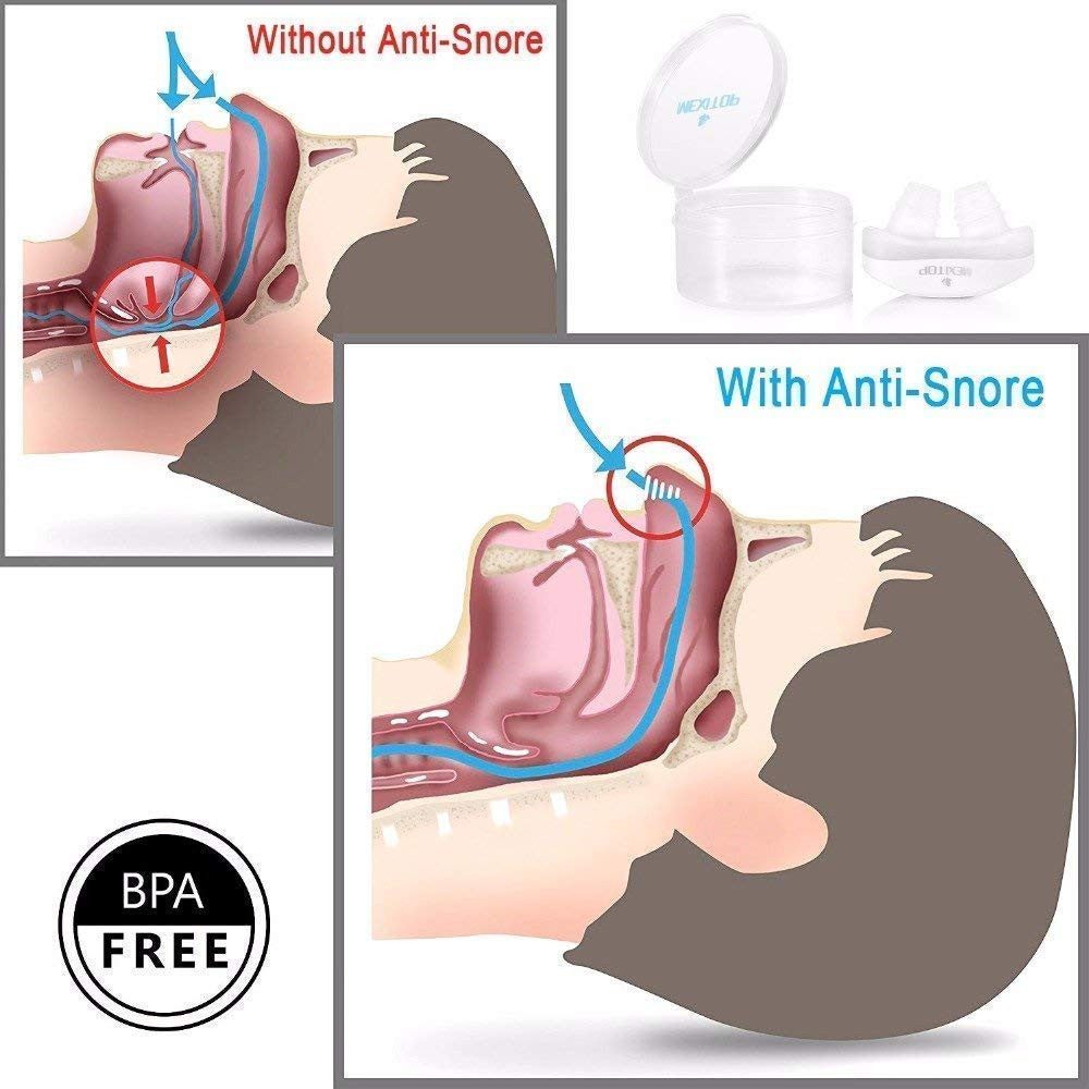 Anti-snoring device M21
